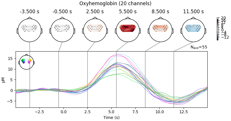 Oxyhemoglobin (20 channels), -3.500 s, -0.500 s, 2.500 s, 5.500 s, 8.500 s, 11.500 s